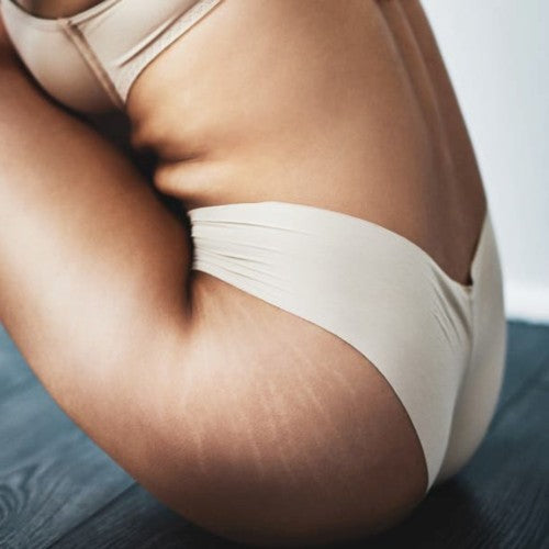 une femme assise en sous-vêtement laisse apparaître ses vergetures